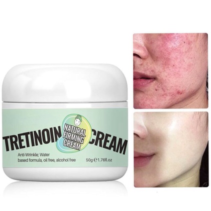 tretinoina